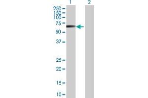 Western Blot analysis of STK38L expression in transfected 293T cell line by STK38L MaxPab polyclonal antibody. (STK38L anticorps  (AA 1-464))