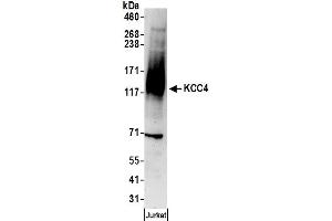 anti-Solute Carrier Family 12 (Potassium-Chloride Transporter) Member 7 (SLC12A7) (AA 950-1000) antibody