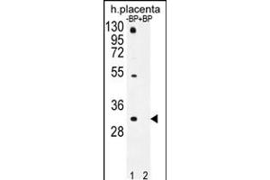 Western blot analysis of OR1D5 Antibody Pab pre-incubated without(lane 1) and with(lane 2) blocking peptide in human placenta tissue lysate. (OR1D5 anticorps  (C-Term))
