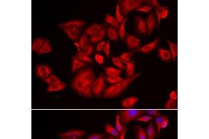 Immunofluorescence analysis of U2OS cells using TLK2 Polyclonal Antibody (TLK2 anticorps)