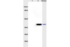 Lane 1: rat kidney lysates Lane 2: rat brain lysates probed with Anti CXCR1/IL-8RA Polyclonal Antibody, Unconjugated (ABIN730873) at 1:200 in 4 °C. (CXCR1 anticorps  (AA 186-280))