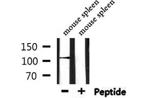 Western blot analysis of extracts from mouse spleen, using DPYD Antibody. (DPYD anticorps  (Internal Region))