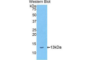 Western Blotting (WB) image for anti-Involucrin (IVL) (AA 461-551) antibody (ABIN1174489) (Involucrin anticorps  (AA 461-551))