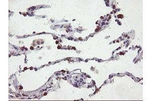 anti-Src-like-adaptor 2 (SLA2) antibody