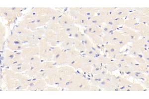 Detection of TRPA1 in Human Cardiac Muscle Tissue using Polyclonal Antibody to Transient Receptor Potential Cation Channel Subfamily A, Member 1 (TRPA1)
