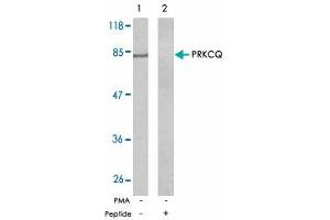 Western blot analysis of exreacts from Jurkat cells untreated or treated with PMA (1 ng/mL, 5 min) using PRKCQ polyclonal antibody . (PKC theta anticorps)