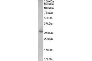 Western Blotting (WB) image for anti-Cyclin-Dependent Kinase Inhibitor 1B (p27, Kip1) (CDKN1B) (Internal Region) antibody (ABIN2465872) (CDKN1B anticorps  (Internal Region))