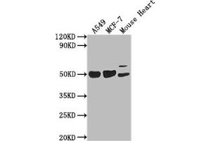 Western Blot Positive WB detected in: A549 whole cell lysate, MCF-7 whole cell lysate, Mouse Heart tissue All lanes: SRGAP2B antibody at 1:2000 Secondary Goat polyclonal to rabbit IgG at 1/50000 dilution Predicted band size: 54 kDa Observed band size: 54 kDa (SLIT-ROBO rho GTPase Activating Protein 2B (SRGAP2B) (AA 79-150) anticorps)