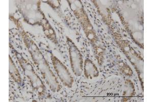 Immunoperoxidase of monoclonal antibody to AKT2 on formalin-fixed paraffin-embedded human small Intestine.