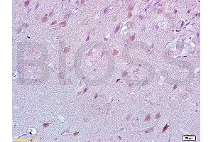 Formalin-fixed and rat brain tissue labeled with Anti-Lingo-1 Polyclonal Antibody, unconjugated  (ABIN738801)  at 1: 200 followed by incubation with conjugated secondary antibody and DAB staining (LINGO1 anticorps  (AA 521-620))