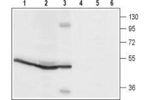 Western blot analysis of rat spleen (lanes 1 and4), rat pancreas (lanes 2 and 5) and mouse B-cell lymphoma (WEHI) (lanes 3 and 6) lysates: - 1-3. (ORAI1 anticorps  (2nd Extracellular Loop))