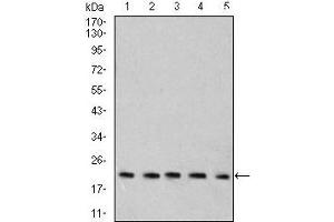 Western blot analysis using Rab6b mouse mAb against C6 (1), SK-N-SH (2), HT-29 (3), PC-12 (4), and C6 (5) cell lysate. (RAB6B anticorps  (AA 95-208))