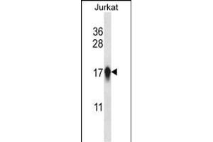 CEN Antibody (Center) (ABIN657764 and ABIN2846742) western blot analysis in Jurkat cell line lysates (35 μg/lane). (CENPA anticorps  (AA 82-110))