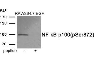 Western blot analysis of extracts from RAW264. (NFKB2 anticorps  (pSer872))