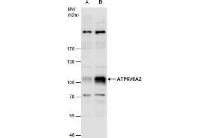 WB Image ATP6V0A2 antibody detects ATP6V0A2 protein by western blot analysis. (ATP6V0A2 anticorps  (Internal Region))