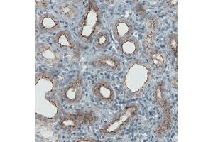 Immunohistochemical staining (Formalin-fixed paraffin-embedded sections) of human kidney with OCLN monoclonal antibody, clone CL1567  shows membranous positivity in renal tubules. (Occludin anticorps  (AA 282-415))