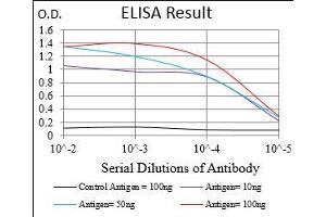 Black line: Control Antigen (100 ng), Purple line: Antigen(10 ng), Blue line: Antigen (50 ng), Red line: Antigen (100 ng),