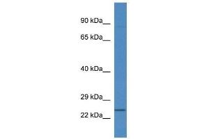 Western Blot showing Rnf183 antibody used at a concentration of 1. (RNF183 anticorps  (N-Term))