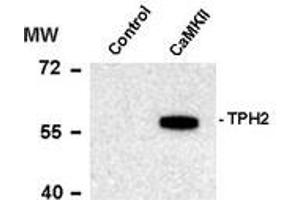 Image no. 1 for anti-Tryptophan Hydroxylase 2 (TPH2) (pSer19) antibody (ABIN372731) (Tryptophan Hydroxylase 2 anticorps  (pSer19))