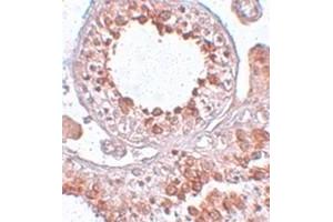 Immunohistochemical staining of human testis tissue with ESX1 polyclonal antibody  at 25 ug/mL dilution. (ESX Homeobox 1 anticorps)