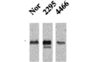 Western Blot analysis of Mouse Ventricle lysates showing detection of CaMKII protein using Mouse Anti-CaMKII Monoclonal Antibody, Clone 22B1 . (CAMKII gamma anticorps  (Biotin))