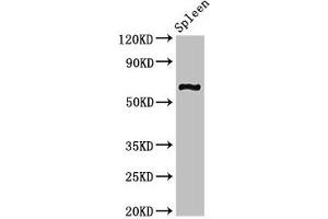Western Blot Positive WB detected in: Mouse spleen tissue All lanes: CNKSR3 antibody at 2 μg/mL Secondary Goat polyclonal to rabbit IgG at 1/50000 dilution Predicted band size: 62, 101, 93 kDa Observed band size: 62 kDa (CNKSR3 anticorps  (AA 301-555))