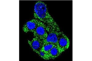 anti-SH2 Domain Containing 4B (SH2D4B) (AA 381-410), (C-Term) antibody