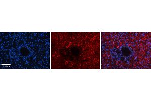 Rabbit Anti-DNAJB12 Antibody   Formalin Fixed Paraffin Embedded Tissue: Human Liver Tissue Observed Staining: Cytoplasm in hepatocytes Primary Antibody Concentration: 1:100 Other Working Concentrations: 1:600 Secondary Antibody: Donkey anti-Rabbit-Cy3 Secondary Antibody Concentration: 1:200 Magnification: 20X Exposure Time: 0. (DNAJB12 anticorps  (Middle Region))
