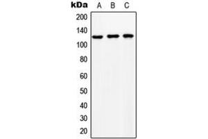 Western blot analysis of NCKX1 expression in HeLa (A), SP2/0 (B), NIH3T3 (C) whole cell lysates. (SLC24A1 anticorps  (Center))