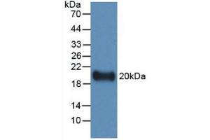Western blot analysis of recombinant Human IL19. (IL-19 anticorps  (AA 25-177))