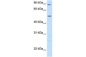 GPT antibody used at 5 ug/ml to detect target protein. (ALT anticorps)