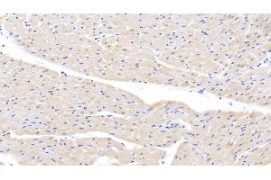 Detection of LOX1 in Bovine Cardiac Muscle Tissue using Polyclonal Antibody to Lectin Like Oxidized Low Density Lipoprotein Receptor 1 (LOX1) (OLR1 anticorps  (AA 57-270))