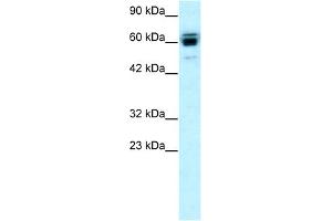 WB Suggested Anti-RNF12 Antibody Titration:  0.