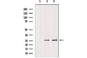 Western blot analysis of extracts from various samples, using TSPAN8 Antibody.