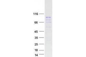 Validation with Western Blot