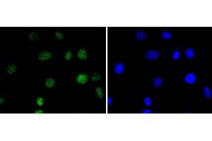 A549 cells were stained with IRF2 (5F2) Monoclonal Antibody  at [1:200] incubated overnight at 4C, followed by secondary antibody incubation, DAPI staining of the nuclei and detection.
