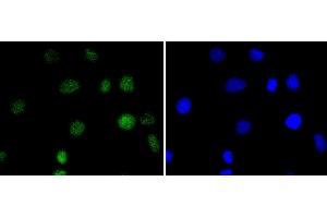 A549 cells were stained with IRF2 (5F2) Monoclonal Antibody  at [1:200] incubated overnight at 4C, followed by secondary antibody incubation, DAPI staining of the nuclei and detection. (IRF2 anticorps)