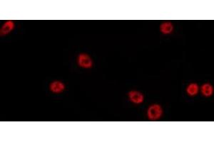 ABIN6275129 staining HepG2 by IF/ICC. (FOXD4L1 anticorps)