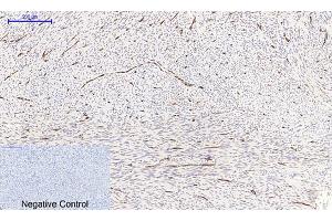 Immunohistochemical analysis of paraffin-embedded human uterus tissue. (NF-kB p65 anticorps  (pSer536))