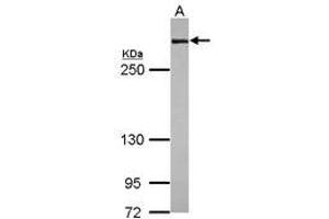 Image no. 1 for anti-Filamin A, alpha (FLNA) (N-Term) antibody (ABIN1494020) (Filamin A anticorps  (N-Term))