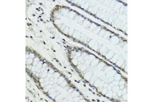 Immunohistochemistry of paraffin-embedded human colon using TRIP12 antibody (ABIN6129753, ABIN6149543, ABIN6149544 and ABIN6225295) at dilution of 1:100 (40x lens). (TRIP12 anticorps  (AA 1-240))