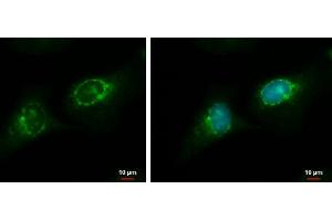 ICC/IF Image RGS7 antibody detects RGS7 protein at endoplasmic reticulum by immunofluorescent analysis.