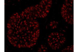 Immunofluorescence (IF) image for anti-RNA polymerase-associated protein RTF1 homolog (RTF1) (C-Term) antibody (ABIN7449019) (RTF1 anticorps  (C-Term))