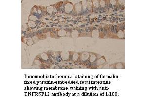 Image no. 1 for anti-Tumor Necrosis Factor Receptor Superfamily, Member 25 (TNFRSF25) (C-Term) antibody (ABIN791096)
