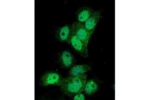 IF analysis of Poliovirus Receptor/PVR using anti-Poliovirus Receptor/PVR antibody (ABIN7601069). (Poliovirus Receptor anticorps  (AA 28-331))