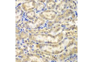 Immunohistochemistry of paraffin-embedded mouse kidney using MBP antibody at dilution of 1:200 (400x lens).