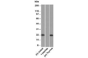 Western blot testing of human Jurkat lysate in the absence and presence of immunizing peptide, and mouse thymus lysate probed with CD3e antibody. (CD3 epsilon anticorps)