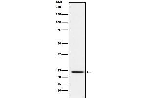 Western blot analysis of FNDC5 expression in Rat muscle cell lysate.