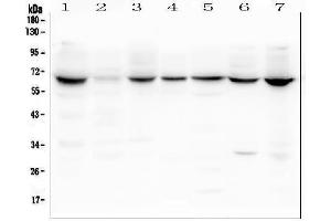 Western blot analysis of LBR using anti-LBR antibody (ABIN6719340). (Lamin B Receptor anticorps  (AA 102-209))