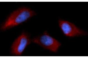 Immunofluorescence (IF) image for anti-N-Ethylmaleimide-Sensitive Factor Attachment Protein, alpha (NAPA) (AA 1-295) antibody (APC) (ABIN5568292) (NAPA anticorps  (AA 1-295) (APC))